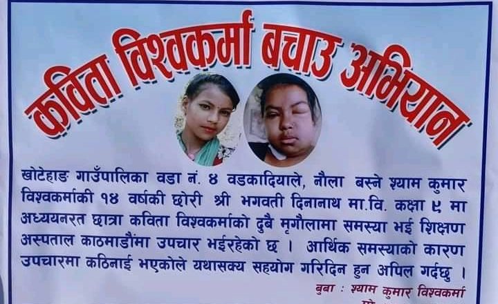 दुवै मिर्गौला फेल भएकी बालिकाको उपचारमा आर्थिक अभाव, परिवारद्वारा सहयोगको अपिल